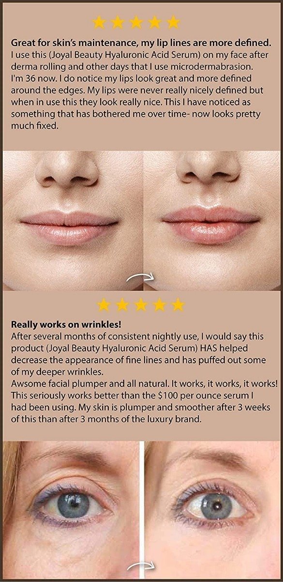 Joyal Beauty Sérum De Ácido Hialurónico Para Cara Natural Tipo De Piel Todo Tipo De Piel - Image 3