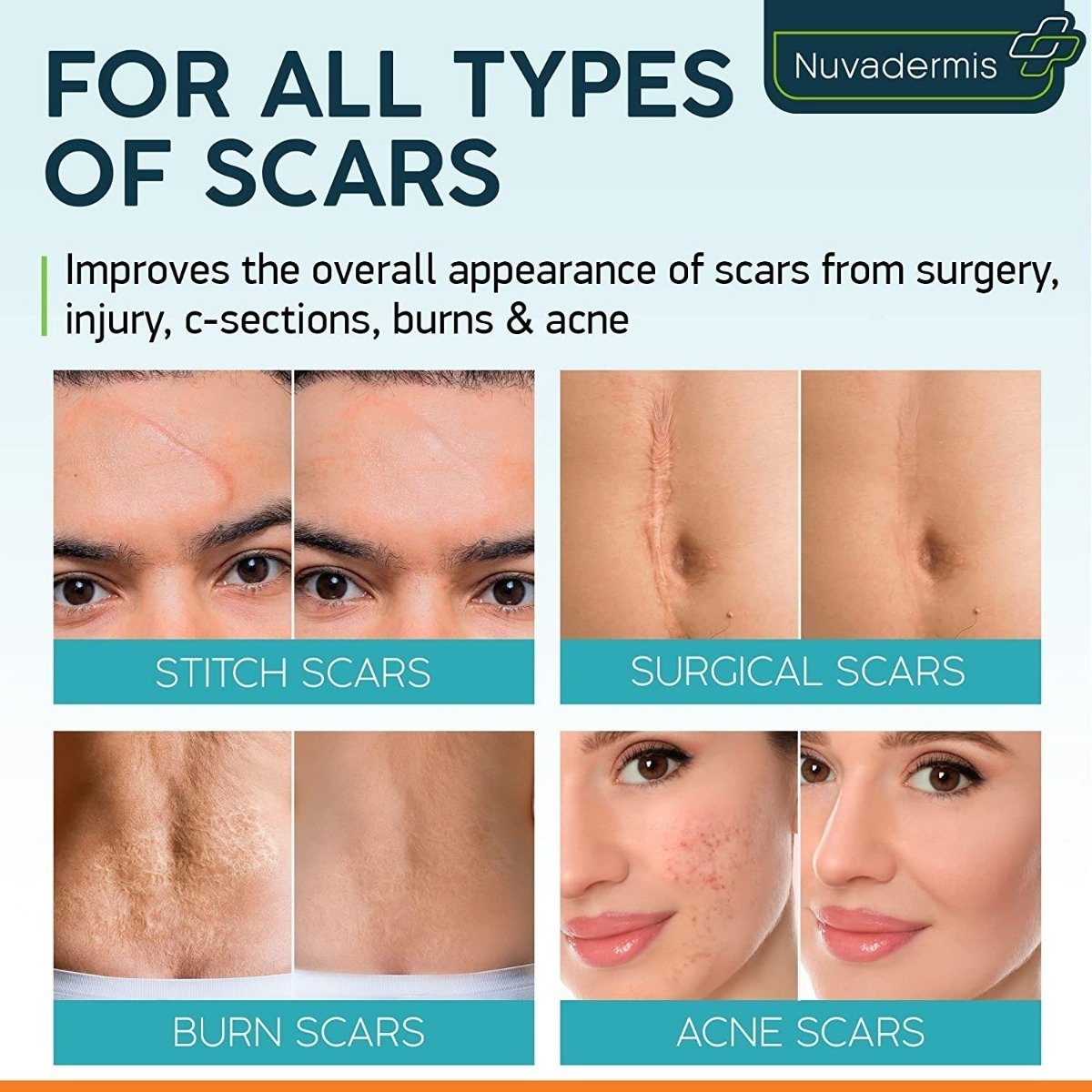 Gel De Crema Para Cicatrices, Retinol, Alantoína, Vitamina E - Image 4