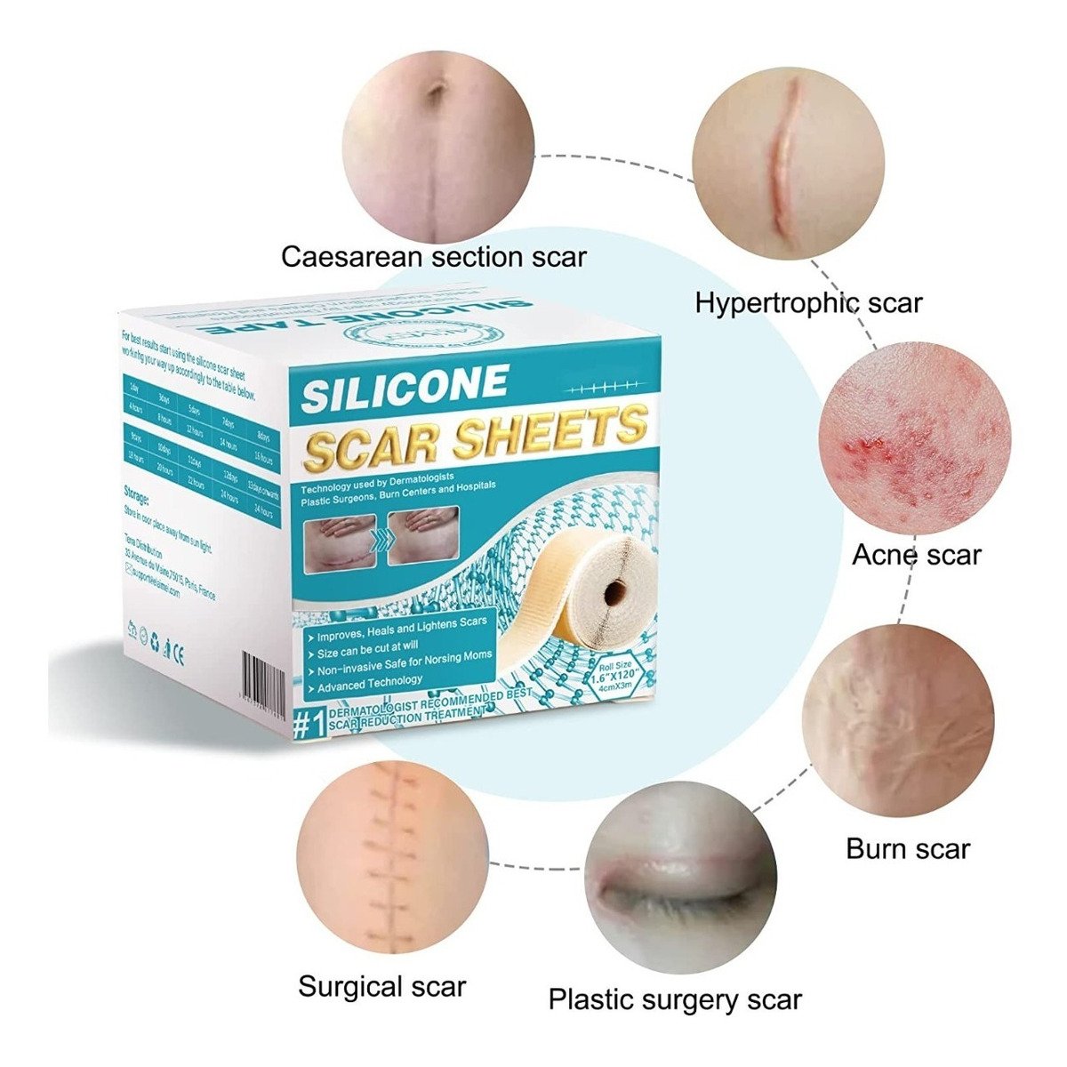 Hojas De Silicona Para Cicatrices Aliver, Cinta De Gel - Image 3