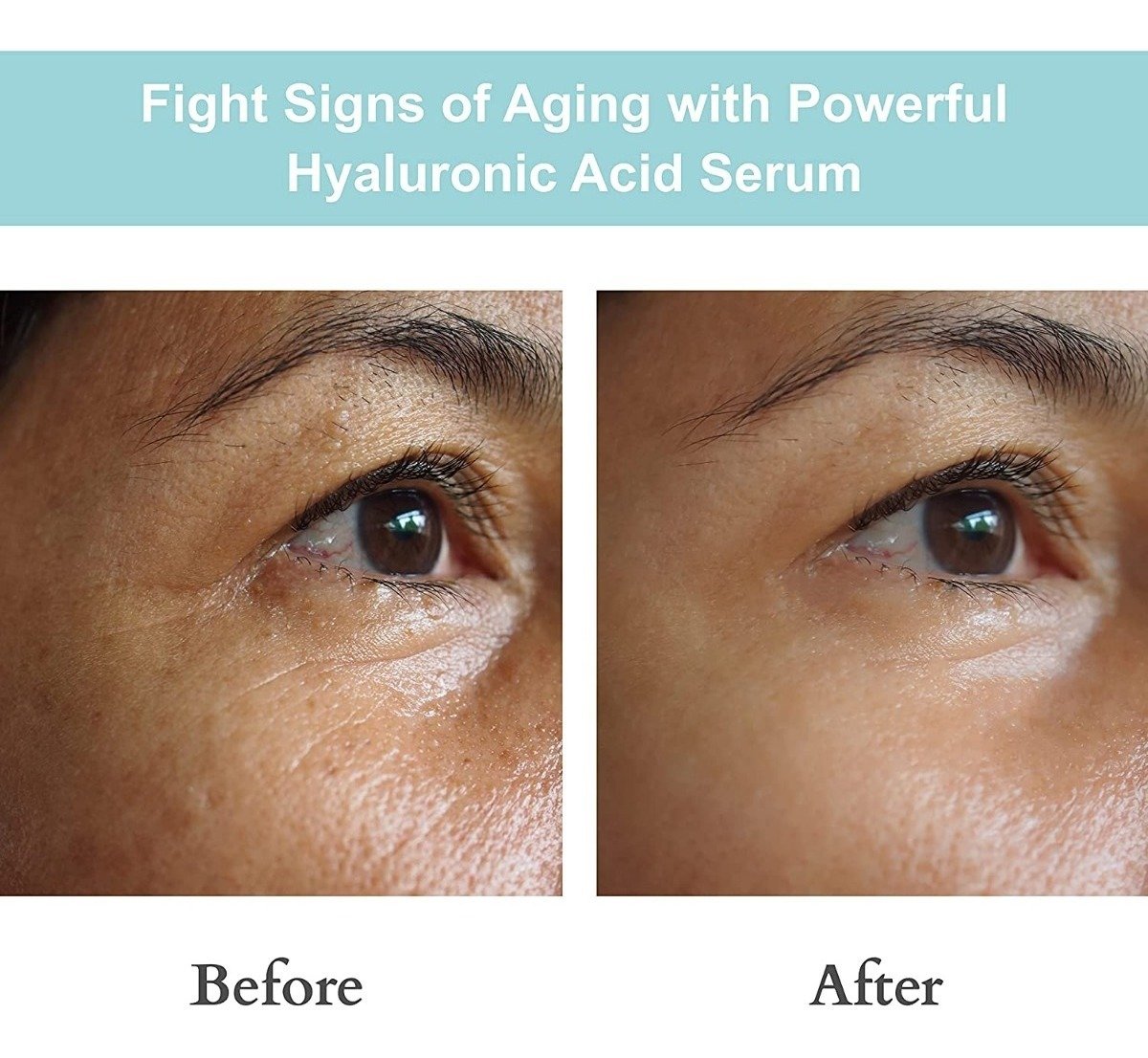 Joyal Beauty Sérum De Ácido Hialurónico Para Cara Natural Tipo De Piel Todo Tipo De Piel - Image 4